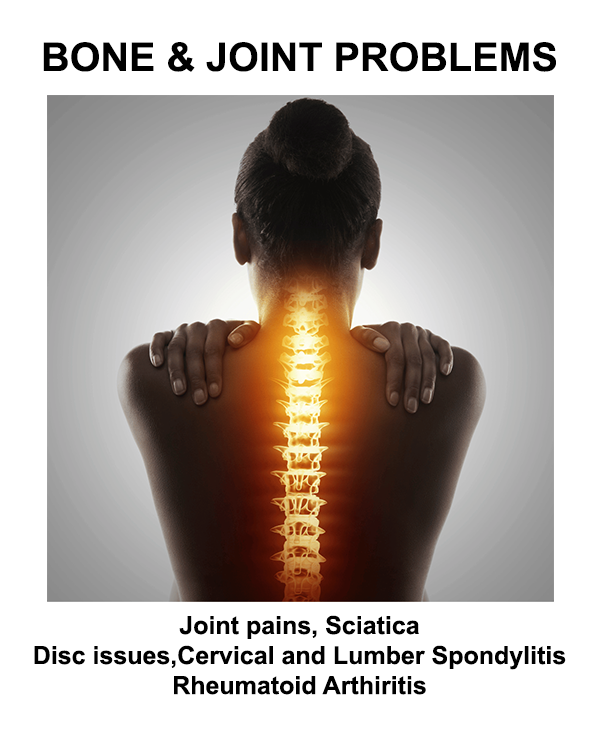 bone-Joint-problems 1