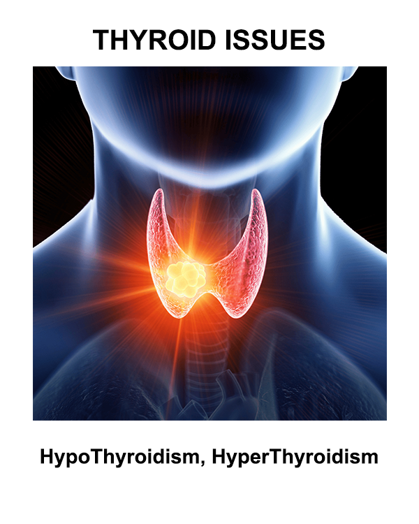 thyroid 1